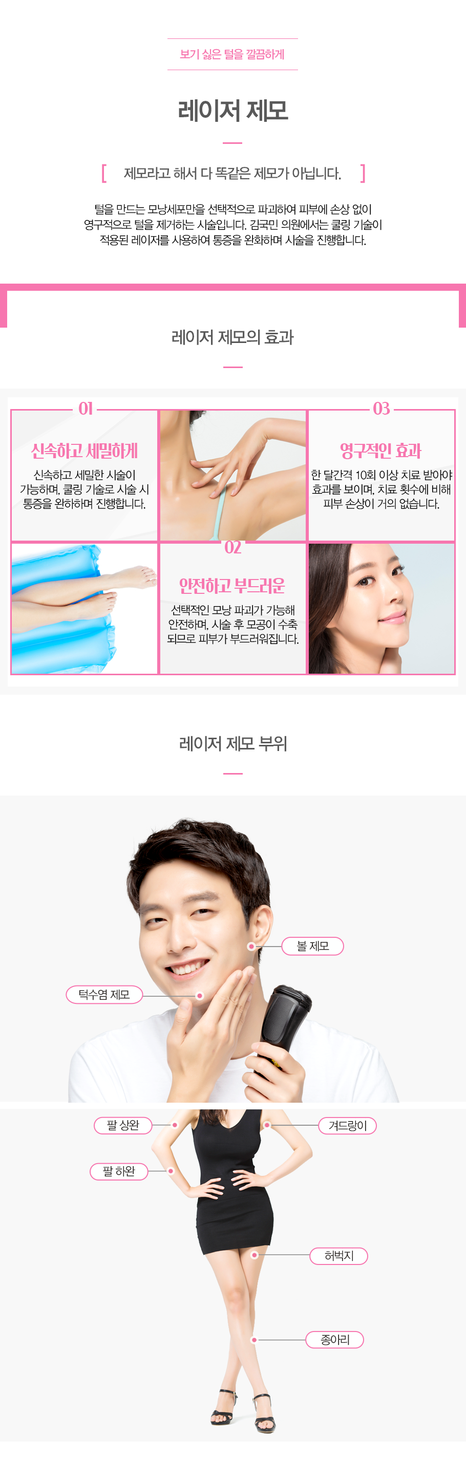 레이저 제모
