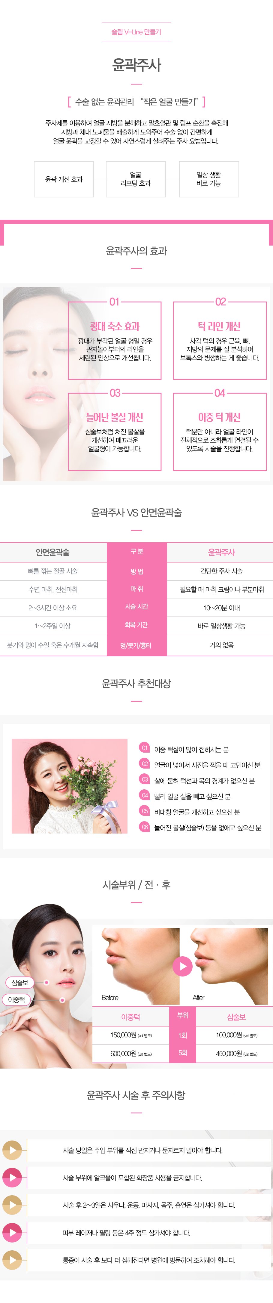 윤곽주사